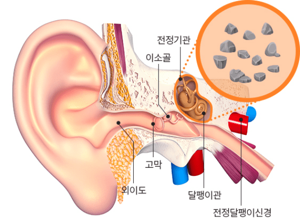 귀 속 전정기관과 반고리관의 구조를 보여주는 이미지