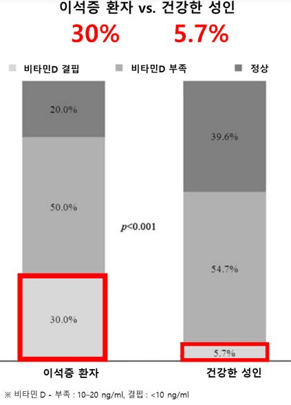 이석증과 비타민D 결핍의 연관성을 다룬 연구 자료