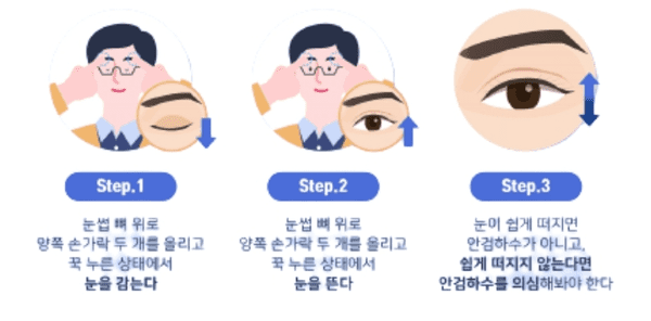눈동자가 가려진 정도로 확인하는 안검하수 자가진단